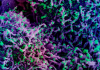 Flurona: Coinfecção entre Covid-19 e Influenza