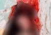 Polícia Civil prende preventivamente mulher após matar gato a pauladas em Timbé do Sul