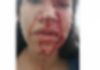 Em Criciúma, mulher é agredida por ladrão durante assalto ao perceber que arma era falsa