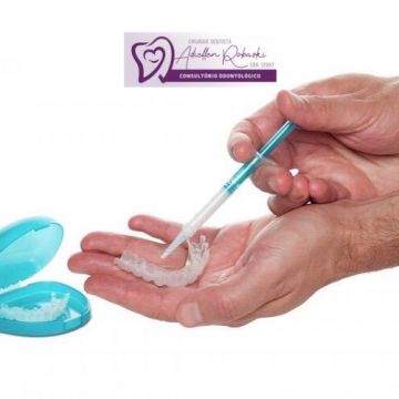 Clareamento dental: o que você precisa saber