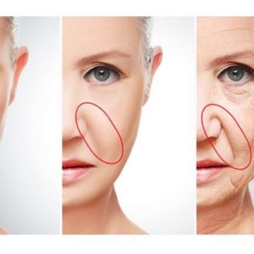 O poder do preenchimento com Ácido Hialurônico para a pele 