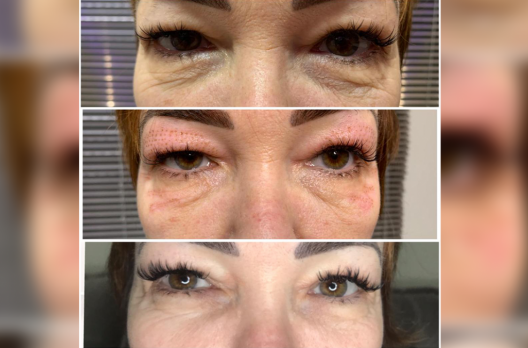 Impactada com esse resultado