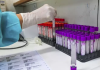 Anvisa aprova mais dois testes de vacinas contra covid-19 no Brasil